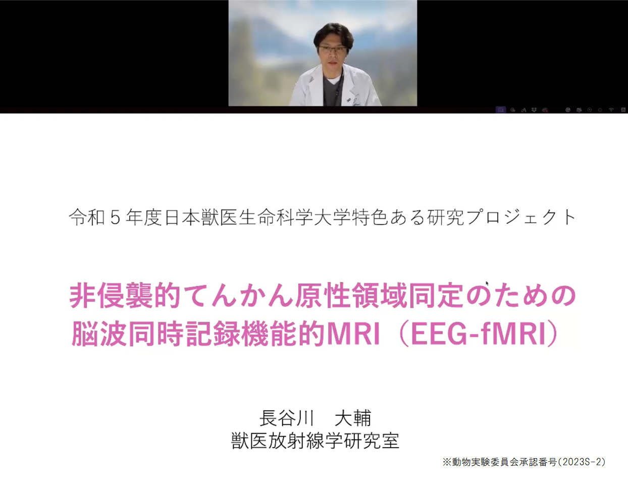 「非侵襲的てんかん原性領域同定のための脳波同時記録機能的MRI（EEG-ｆMRI）」