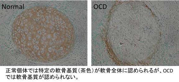 骨軟骨形成不全症（osteochondrodysplasia: OCD）ラット