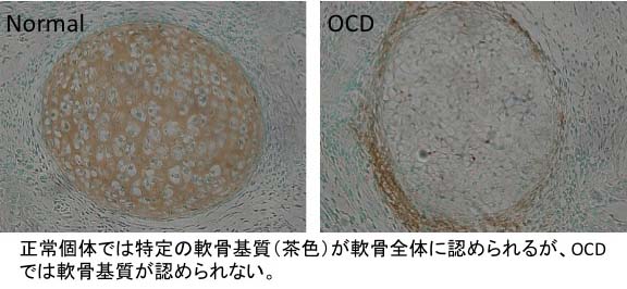 骨軟骨形成不全症（osteochondrodysplasia: OCD）ラット