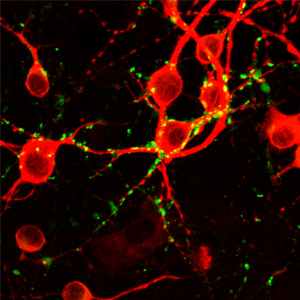 培養神経細胞（赤）とシナプス（緑）