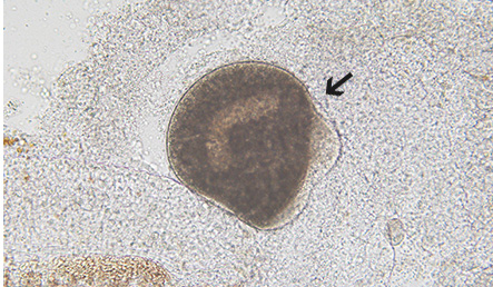 鰓に寄生していた白点虫（矢印）。