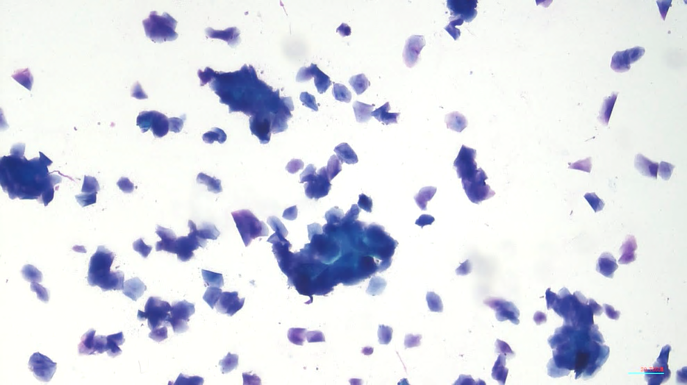 犬の腟垢検査（発情期では角化上皮細胞の増加が認められる）