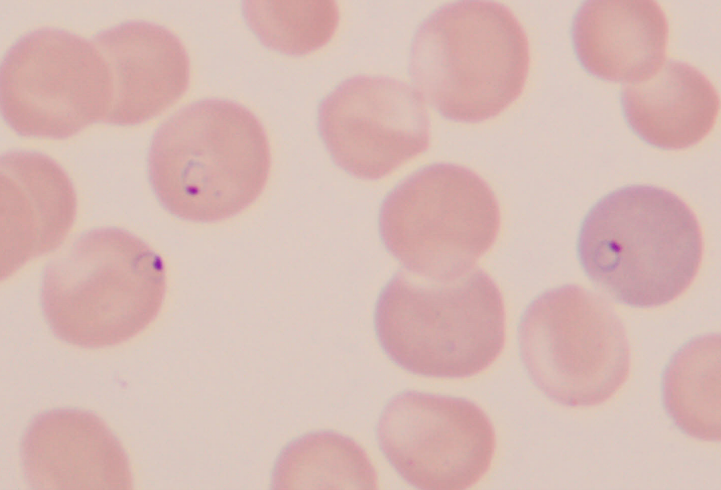 Babesia gibsoni感染犬の血液塗抹標本。赤血球内に小型のリング状から楕円形を呈するBabesia gibsoni原虫が認められる。本症では溶血性貧血を呈することが多く、血液塗抹標本上では赤血球寄生原虫の確認が診断の一助となる。