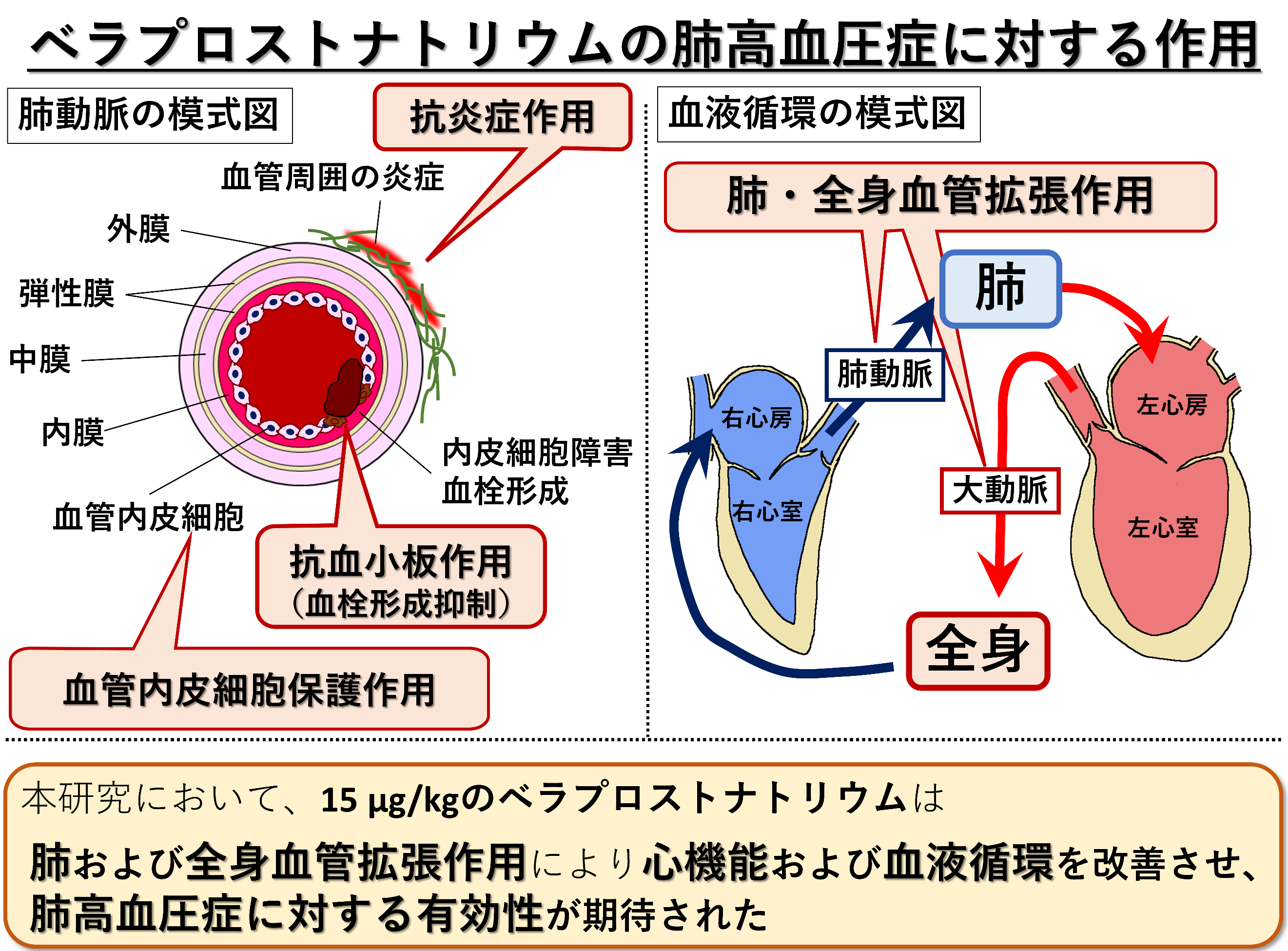 ベラプロストナトリウムは犬の肺高血圧症に対する新たな治療選択肢になる